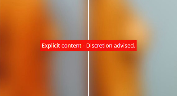 Breast Augmentation Before & After Photos