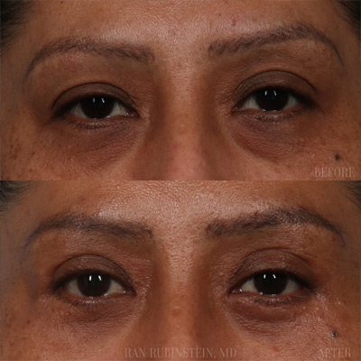 Dr. Ran Rubinstein Instagram