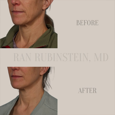 Dr. Ran Rubinstein Instagram