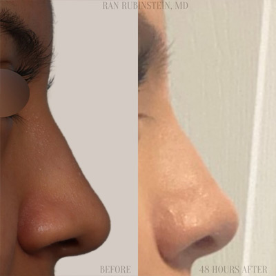 Dr. Ran Rubinstein Instagram