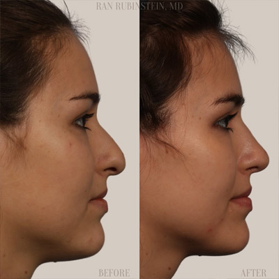 Dr. Ran Rubinstein Instagram