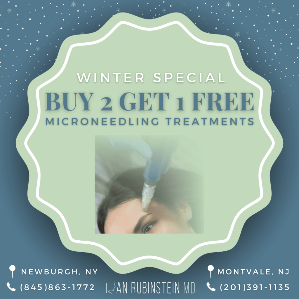 Winter Special