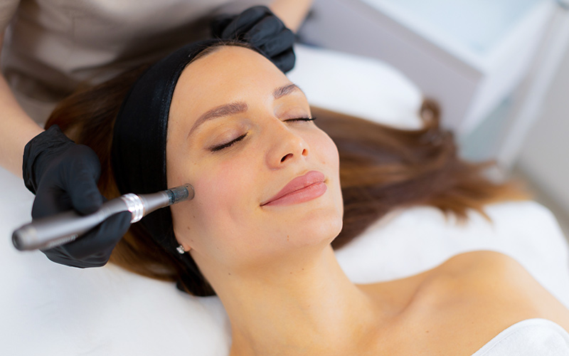 Microneedling treatment on woman’s cheek using dermapen to stimulate collagen and improve skin texture and tone.