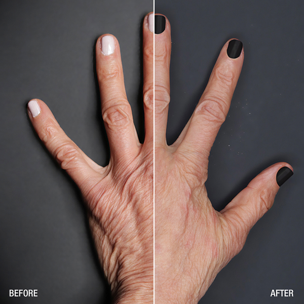 renuva-ba-rubinstein-plastic-surgery-center-10