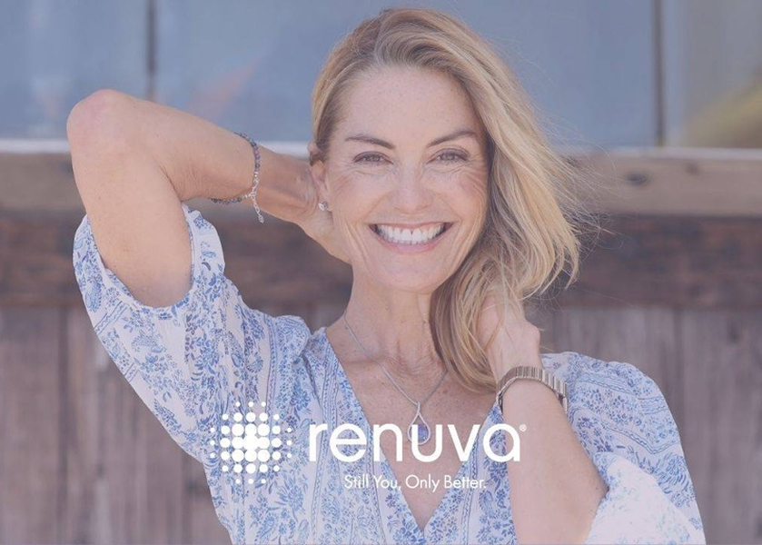 Smiling woman representing Renuva treatment results with natural facial volume restoration and improved skin appearance