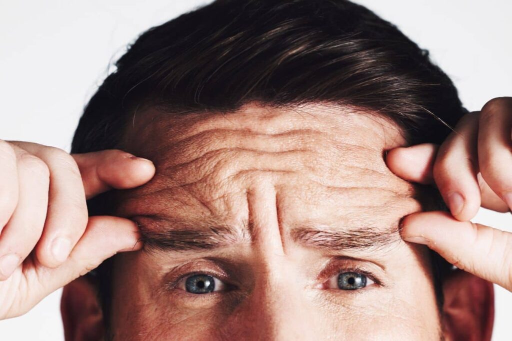 Man showing forehead wrinkles and frown lines, highlighting common Botox and Dysport treatment areas for facial rejuvenation