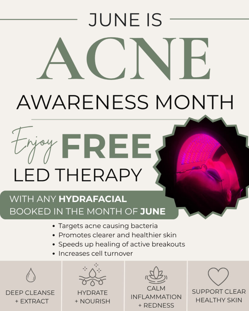Acne special